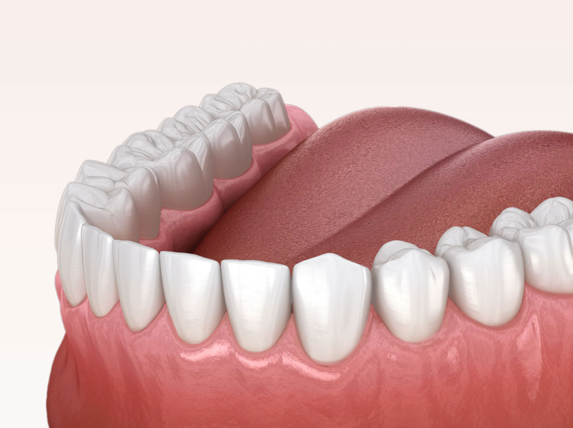 Zahnreinigung Dentalreinigung Wollerau